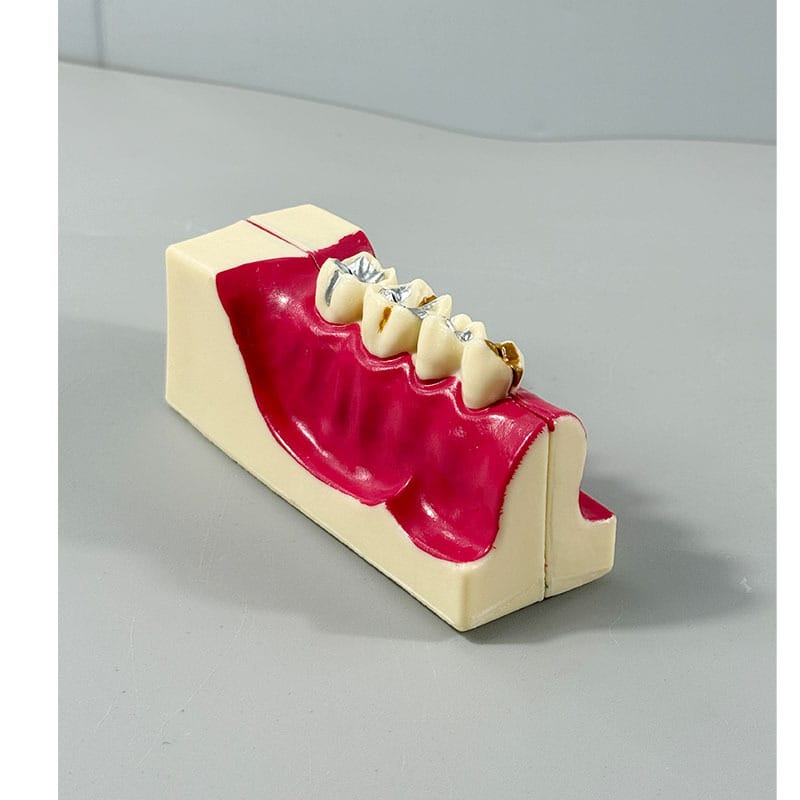 Right Lower Jaw Tooth Anatomy Sectional Model - Mandibular Molar Cross ...