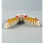 Right Lower Jaw Tooth Anatomy Sectional Model - Mandibular Molar Cross-Section with Restorations for Patient Education & Teaching