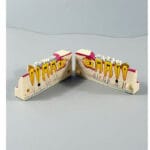 Right Lower Jaw Tooth Anatomy Sectional Model - Mandibular Molar Cross-Section with Restorations for Patient Education & Teaching