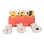 4 Times Enlarged Dental Caries Evolution Model with Detachable Teeth - Tooth Decay Progression Demonstration for Patient Education & Teaching