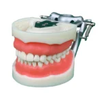 32 Teeth Dental Preparation Model with Articulator - Full Arch Crown Prep Demonstration for Teaching & Education