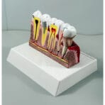 Tooth Anatomy Model with Nerve Distribution - Dental Pulp & Nerve Highlighted Cross-Section for Patient Education & Teaching - Image 2