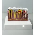 Tooth Anatomy Model with Nerve Distribution - Dental Pulp & Nerve Highlighted Cross-Section for Patient Education & Teaching