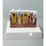 Tooth Anatomy Model with Nerve Distribution - Dental Pulp & Nerve Highlighted Cross-Section for Patient Education & Teaching