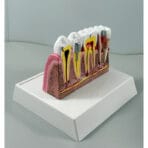 Tooth Anatomy Model with Nerve Distribution - Dental Pulp & Nerve Highlighted Cross-Section for Patient Education & Teaching - Image 3