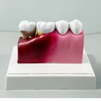 Tooth Anatomy Model with Nerve Distribution - Dental Pulp & Nerve Highlighted Cross-Section for Patient Education & Teaching - Image 5