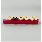 Dental Caries Progression Model - 5 Stages: Normal, Shallow, Moderate, Advanced, Residual Root with Succedaneous Teeth for Patient Education - Image 3