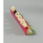 Dental Caries Progression Model - 5 Stages: Normal, Shallow, Moderate, Advanced, Residual Root with Succedaneous Teeth for Patient Education - Image 4