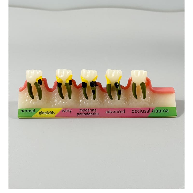 生产口腔牙齿模型牙科礼品饰品牙周B分类模型牙科示教模型 阿里巴巴 widioo