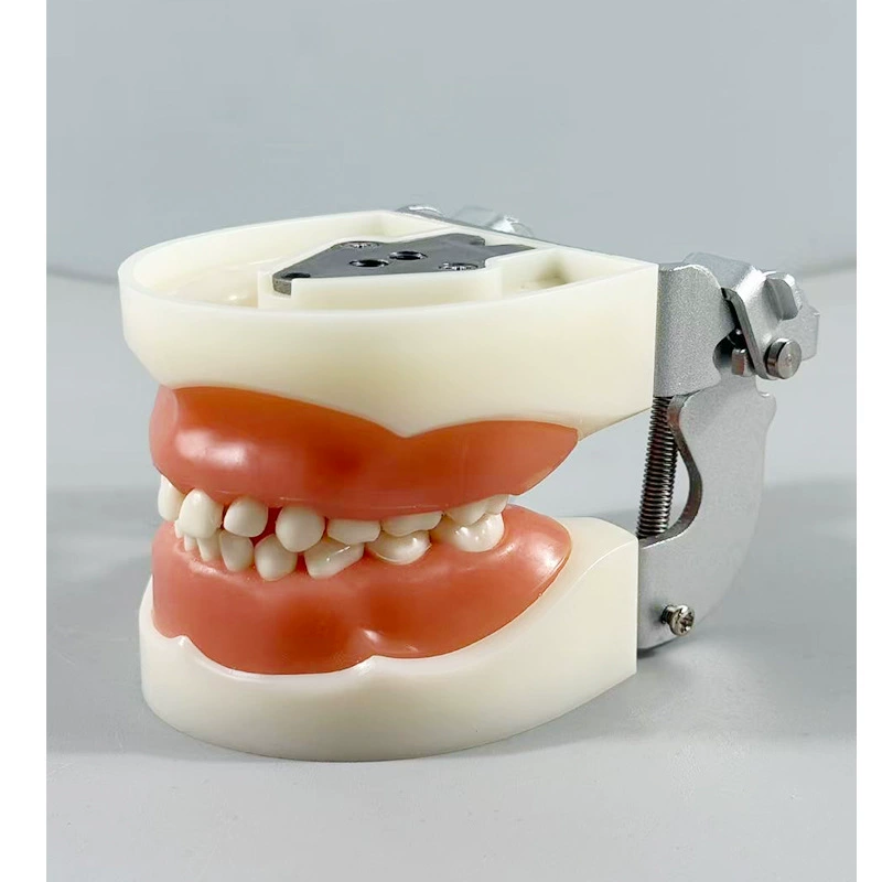 Pediatric Tooth Preparation Model for Crowns - Children's Deciduous Teeth Prep with Screws, Crowns & Screwdriver for Education
